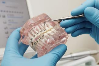 Orthodontics | Alfonso Dental Clinic